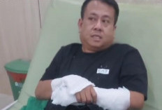 Aktivis Basel Disiram Air Keras Dua Pengendara Misterius