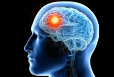 Tes IQ untuk Asah Otak